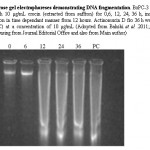 图4:琼脂糖凝胶电泳显示DNA片段