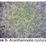 图3- acanthamoeba cysts（x100）