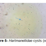 图5- Hartmanellidae囊肿（x100）