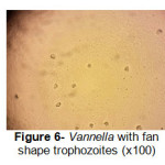 图6- Vannella带风扇形状滋养色素（X100）