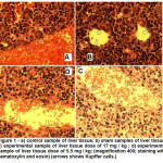 图1 - a)肝组织对照样本;B)肝组织假标本;C)实验样品肝组织剂量为17 mg / kg;D)实验样品肝组织剂量5.5 mg / kg;(放大400;苏木精和伊红染色)(箭头为枯ffer细胞。)