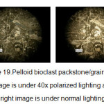 图19所示。图左为40倍偏振光下的球粒生物碎屑包屑/颗粒岩，右图为正常光下的生物碎屑包屑