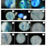 图1：菌根菌菌（C，F，H，I，J，K，L），枝叶（D，J），囊泡（A，B，e，g），在研究的植物的根皮层（Artocarpus heterophyllus）中在BCSIR储备林。